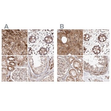 Anti-NUP43 antibody produced in rabbit Prestige Antibodies&#174; Powered by Atlas Antibodies, affinity isolated antibody, buffered aqueous glycerol solution, ab1