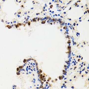 Anti-IKBKG antibody produced in rabbit