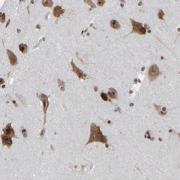 Anti-CSRNP3 antibody produced in rabbit Prestige Antibodies&#174; Powered by Atlas Antibodies, affinity isolated antibody, buffered aqueous glycerol solution