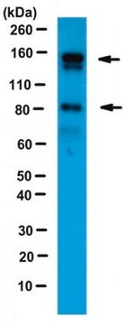 Anti-Angiomotin Antibody serum, from rabbit