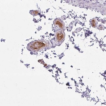 Anti-SERPIND1 antibody produced in rabbit Prestige Antibodies&#174; Powered by Atlas Antibodies, affinity isolated antibody, buffered aqueous glycerol solution