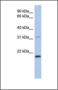 Anti-CLECL1 antibody produced in rabbit affinity isolated antibody