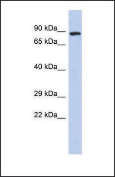 Anti-ZFYVE20, (N-terminal) antibody produced in rabbit affinity isolated antibody