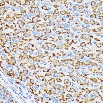 Anti-p70 S6 Kinase 2 antibody produced in rabbit