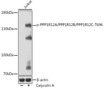 Anti-Phospho-PPP1R12A/PPP1R12B/PPP1R12C-T696 antibody produced in rabbit