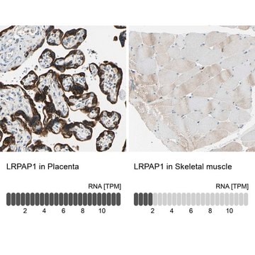 Anti-LRPAP1 antibody produced in rabbit Prestige Antibodies&#174; Powered by Atlas Antibodies, affinity isolated antibody, buffered aqueous glycerol solution