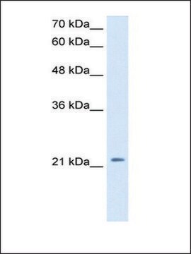 Anti-DKK1 antibody produced in rabbit IgG fraction of antiserum