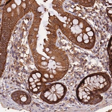 Anti-MARK4 antibody produced in rabbit Prestige Antibodies&#174; Powered by Atlas Antibodies, affinity isolated antibody, buffered aqueous glycerol solution