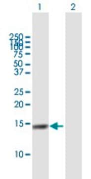 Anti-CST4 antibody produced in mouse purified immunoglobulin, buffered aqueous solution