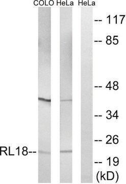 Anti-RPL18 antibody produced in rabbit affinity isolated antibody