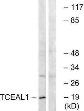 Anti-TCEAL1 antibody produced in rabbit affinity isolated antibody