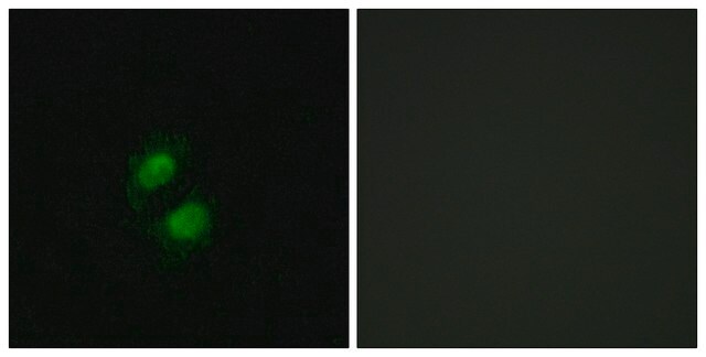 Anti-ZNF95 antibody produced in rabbit affinity isolated antibody