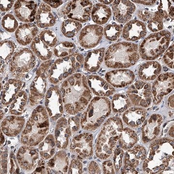 Anti-SMPDL3A antibody produced in rabbit Prestige Antibodies&#174; Powered by Atlas Antibodies, affinity isolated antibody, buffered aqueous glycerol solution