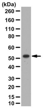 Anti-PTRF/Cavin-1 Antibody from rabbit, purified by affinity chromatography