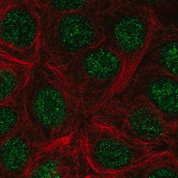 Anti-KLLN antibody produced in rabbit Prestige Antibodies&#174; Powered by Atlas Antibodies, affinity isolated antibody