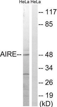 Anti-AIRE antibody produced in rabbit affinity isolated antibody