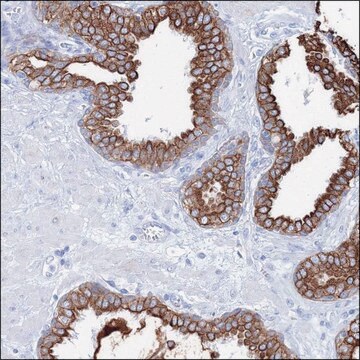 Anti-PLA2G7 antibody produced in rabbit Prestige Antibodies&#174; Powered by Atlas Antibodies, affinity isolated antibody, buffered aqueous glycerol solution