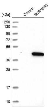 Anti-SNRNP40 antibody produced in rabbit Prestige Antibodies&#174; Powered by Atlas Antibodies, affinity isolated antibody, buffered aqueous glycerol solution