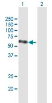 Anti-VEGFC antibody produced in mouse purified immunoglobulin, buffered aqueous solution