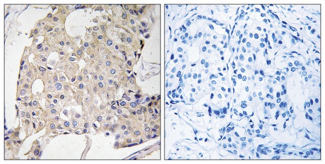 Anti-NDRG3 antibody produced in rabbit affinity isolated antibody