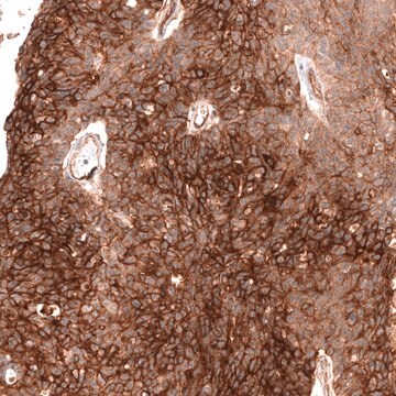 Monoclonal Anti-Fxyd5 Antibody Produced In Mouse Prestige Antibodies&#174; Powered by Atlas Antibodies, clone CL14039, affinity isolated antibody, buffered aqueous glycerol solution