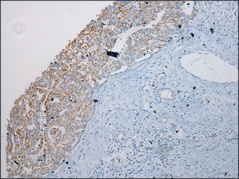 Anti-SLC6A19 affinity isolated antibody