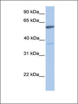 Anti-NAB2 antibody produced in rabbit affinity isolated antibody