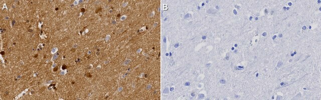 Anti-PTPRZ1 Antibody, clone 1J4 ZooMAb&#174; Rabbit Monoclonal recombinant, expressed in HEK 293 cells