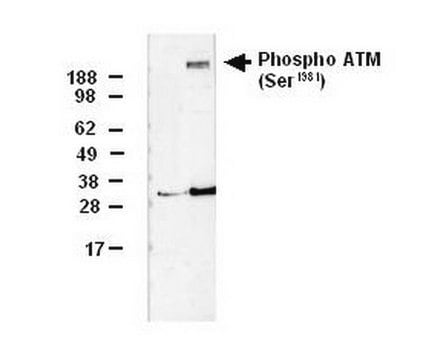 PhosphoDetect Anti-ATM (pSer&#185;&#8313;&#8312;&#185;) Mouse mAb (10H11.E12) liquid, clone 10H11.E12, Calbiochem&#174;