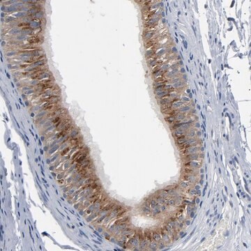 Anti-YIPF6 antibody produced in rabbit Prestige Antibodies&#174; Powered by Atlas Antibodies, affinity isolated antibody, buffered aqueous glycerol solution