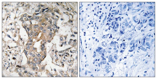 Anti-SPHK2 antibody produced in rabbit affinity isolated antibody