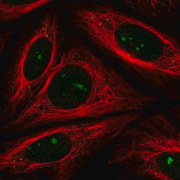 Anti-FBXW11 antibody produced in rabbit Prestige Antibodies&#174; Powered by Atlas Antibodies, affinity isolated antibody