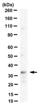 Anti-GnRH-R Antibody, clone F1G4 clone FIG4, from mouse