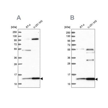 Anti-TRMT112 antibody produced in rabbit Prestige Antibodies&#174; Powered by Atlas Antibodies, affinity isolated antibody, buffered aqueous glycerol solution