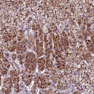 Anti-CARS2 antibody produced in rabbit Prestige Antibodies&#174; Powered by Atlas Antibodies, affinity isolated antibody, buffered aqueous glycerol solution