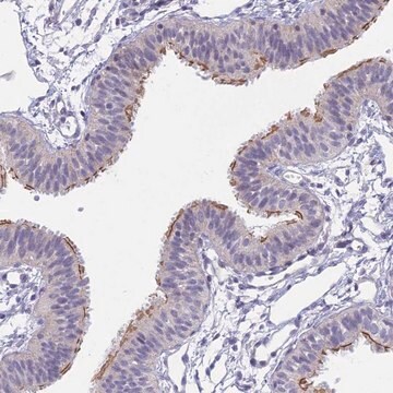 Anti-CFAP206 antibody produced in rabbit Prestige Antibodies&#174; Powered by Atlas Antibodies, affinity isolated antibody, buffered aqueous glycerol solution