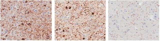 Anticorps anti-phospho-&#945;-synucléine (Ser129), clone&nbsp;81A clone 81A, from mouse