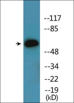 Anti-phospho-Chk2 (pSer516) antibody produced in rabbit affinity isolated antibody