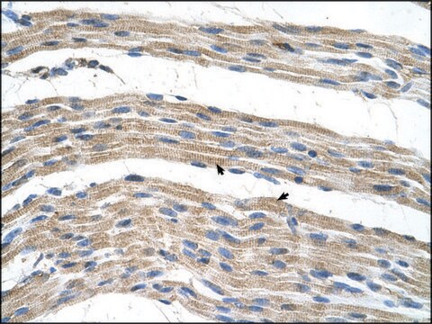 Anti-SLC17A4 antibody produced in rabbit affinity isolated antibody