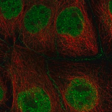 Anti-Terb1 Antibody Produced In Rabbit Prestige Antibodies&#174; Powered by Atlas Antibodies, affinity isolated antibody, buffered aqueous glycerol solution