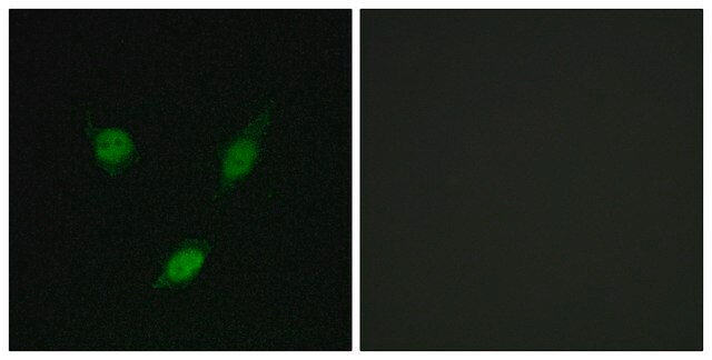 Anti-TACC1 antibody produced in rabbit affinity isolated antibody