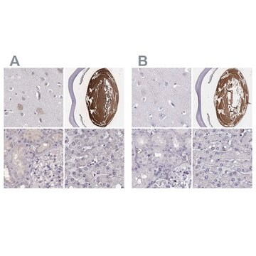 Anti-BFSP2 antibody produced in rabbit Prestige Antibodies&#174; Powered by Atlas Antibodies, affinity isolated antibody