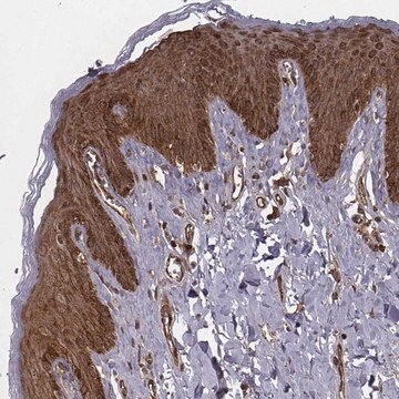 Anti-RPL3 antibody produced in rabbit Prestige Antibodies&#174; Powered by Atlas Antibodies, affinity isolated antibody