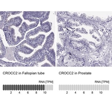 Anti-CROCC2 antibody produced in rabbit affinity isolated antibody, buffered aqueous glycerol solution