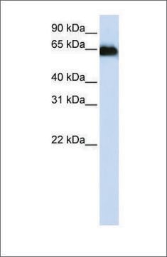 Anti-ADAM12 antibody produced in rabbit affinity isolated antibody