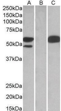 Anti-TRIM21 (C-terminal) antibody produced in goat affinity isolated antibody, buffered aqueous solution