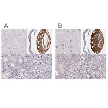 Anti-BFSP2 antibody produced in rabbit Prestige Antibodies&#174; Powered by Atlas Antibodies, affinity isolated antibody, buffered aqueous glycerol solution