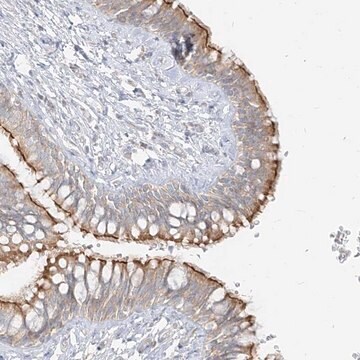 Anti-ZIM3 antibody produced in rabbit Prestige Antibodies&#174; Powered by Atlas Antibodies, affinity isolated antibody, buffered aqueous glycerol solution