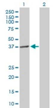 Anti-LPGAT1 antibody produced in mouse purified immunoglobulin, buffered aqueous solution