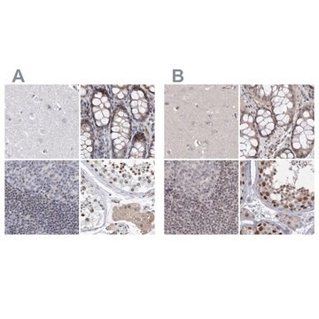 Anti-UIMC1 antibody produced in rabbit Prestige Antibodies&#174; Powered by Atlas Antibodies, affinity isolated antibody, buffered aqueous glycerol solution